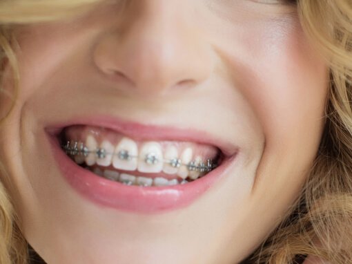 Orthodontie - Centre dentaire Ravis